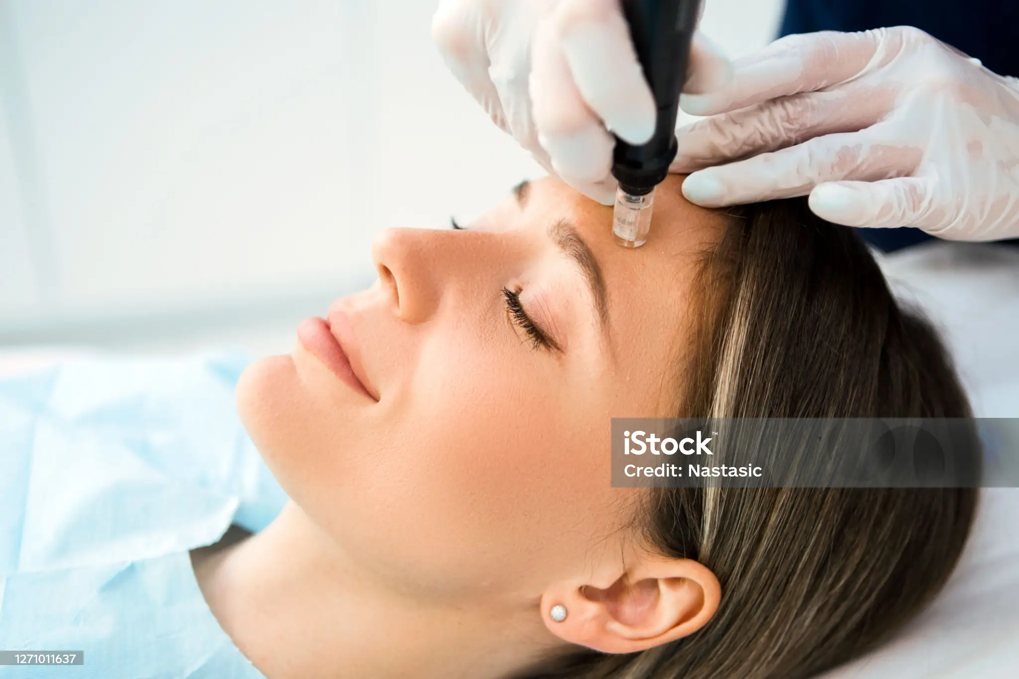 Micro-Needling